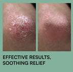 Psoramist Cream 150g