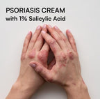 Psoramist Cream 150g